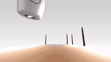 Mini Laser Hair Removal Portable / جهاز إزالة الشعر بالليزر القابل للحمل view 3